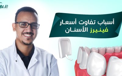 2022 اسعار فينير الاسنان في مصر