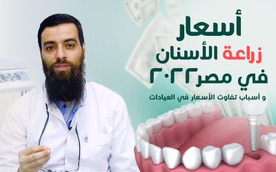 اسعار زراعة الاسنان في مصر 2022