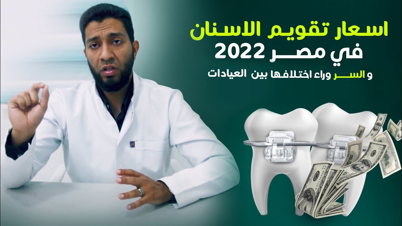 اسعار تقويم الاسنان في مصر 2022 و السر وراء إختلافها بين العيادات | د/ مصطفى الشيتي 